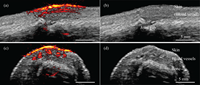 Photoacoustic/ultrasound images taken with the new system show a human finger joint from different angles. The images on the right (b and d) show anatomical structures revealed by the ultrasound. The images on the left (a and c) show the photoacoutics data overlaying the ultrasound data. The bright yellow and red at the top of the finger show the skin and blood vessels running parallel to the finger. Credit: Pim van den Berg/ Khalid Daoudi