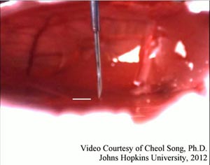 Video of the CAD model and prototype of the fiber-optic-sensor-based microsurgical tool, SMART. Courtesy Cheol Song, Johns Hopkins University.